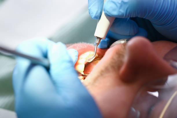 Best Emergency Tooth Extraction in Rawls Springs, MS