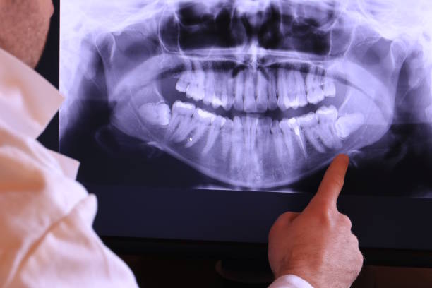 Best Emergency Dental Care for Trauma or Injury in Rawls Springs, MS