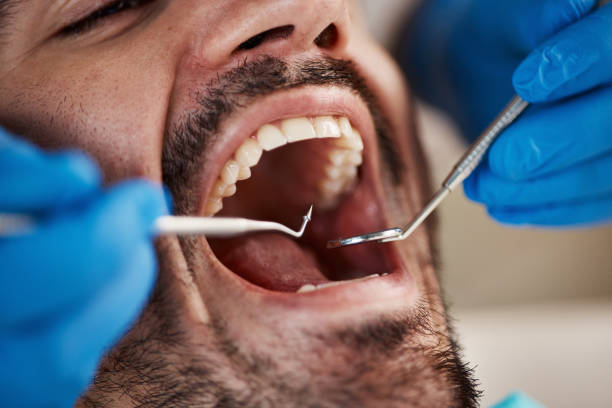 Best Emergency Broken Tooth Repair in Rawls Springs, MS