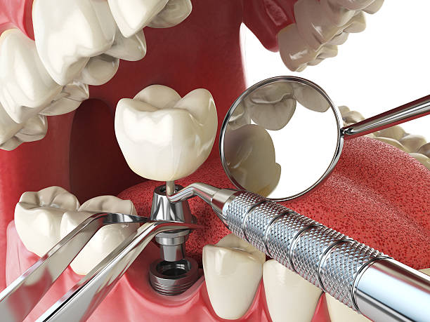 Best Same-Day Emergency Dentist in Rawls Springs, MS