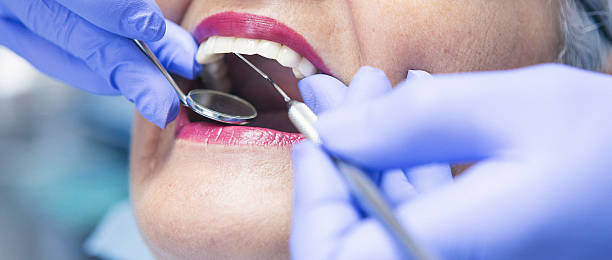 Best Emergency Root Canal Treatment in Rawls Springs, MS